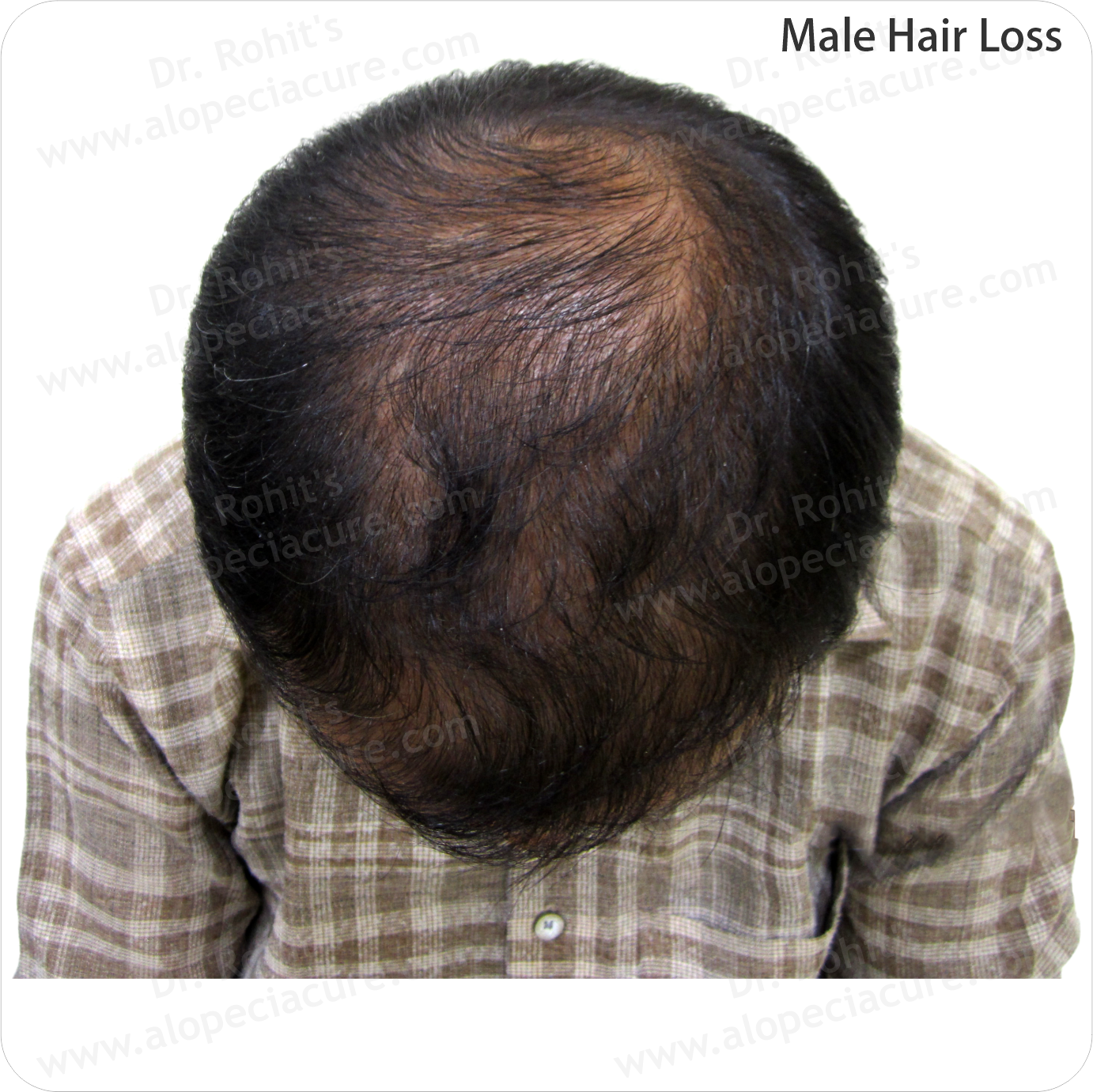 Clinical Hair Treatment