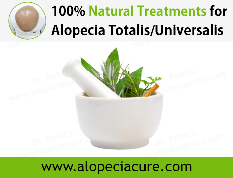 100% Natural Treatments for Alopecia Areata