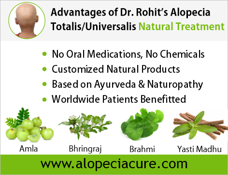 Advantages of Dr. Rohit's Alopecia Areata Natural Treatment