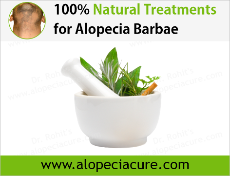 100% Natural Treatments for Alopecia Areata