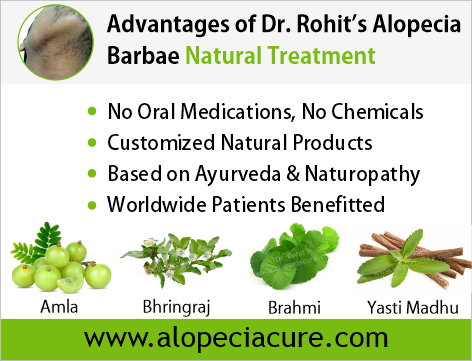 Advantages of Dr. Rohit's Alopecia Areata Natural Treatment
