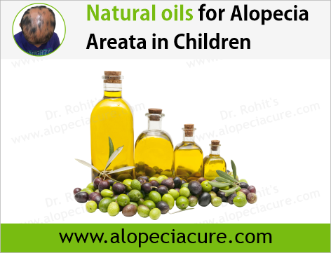 100% Natural Oils for Alopecia Areata