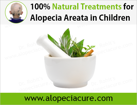100% Natural Treatments for Alopecia Areata