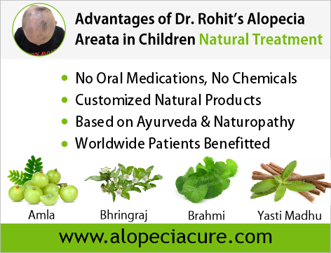 Advantages of Dr. Rohit's Alopecia Areata Natural Treatment