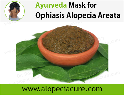 Ayurveda Mask for Ophiasis Alopecia Areata