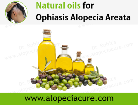 100% Natural Oils for Ophiasis Alopecia Areata