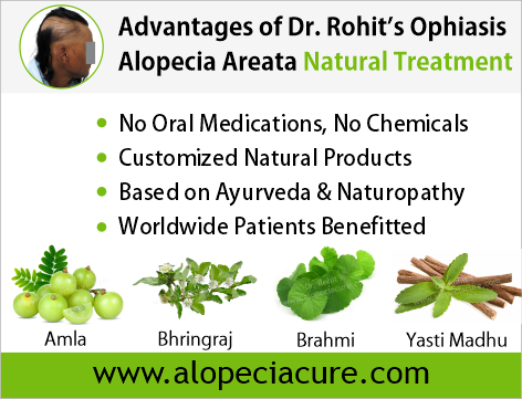 Advantages of Dr. Rohit's Ophiasis Alopecia Areata Natural Treatment