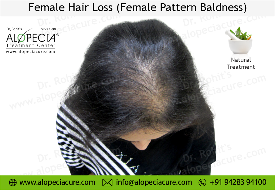 Conventional Treatments vs Natural Therapy for Women