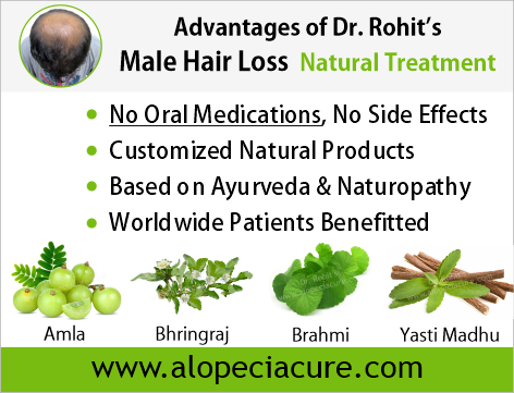 Advantages of Dr. Rohit's Male Hair Loss Natural Treatment