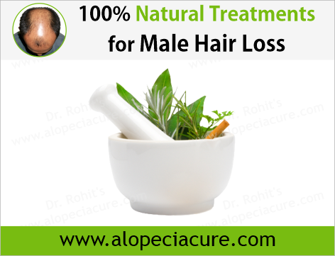 100% Natural Treatments for Male Hair Loss
