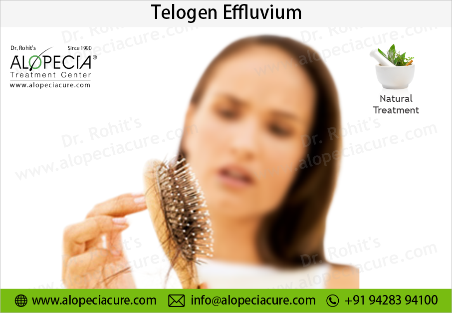 Clinical Overview of Telogen Effluvium