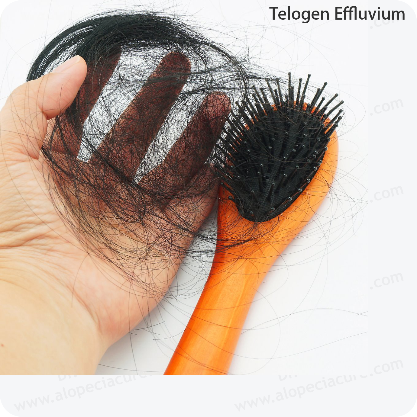 Telogen Effluvium Clinical Treatment Slide 3