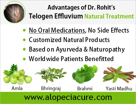 Advantages of Dr. Rohit's Telogen Effluvium Natural Treatment