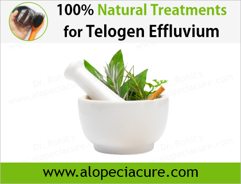 100% Natural Treatments for Telogen Effluvium
