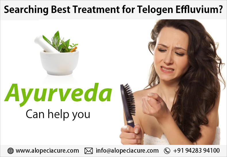 Overview of Telogen Effluvium
