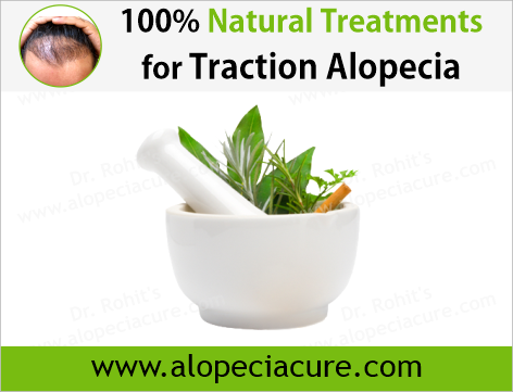 100% Natural Treatments for Traction Alopecia